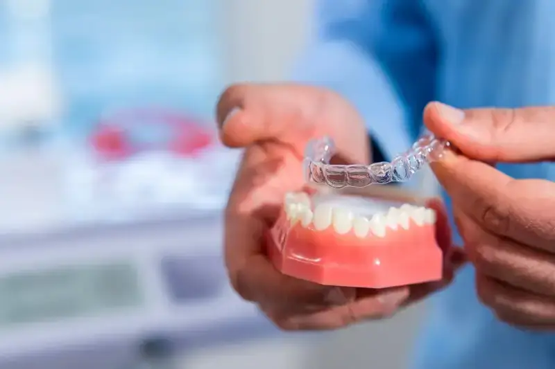 Aparat Invisalign