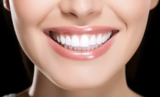 Co to są licówki i ile kosztują?