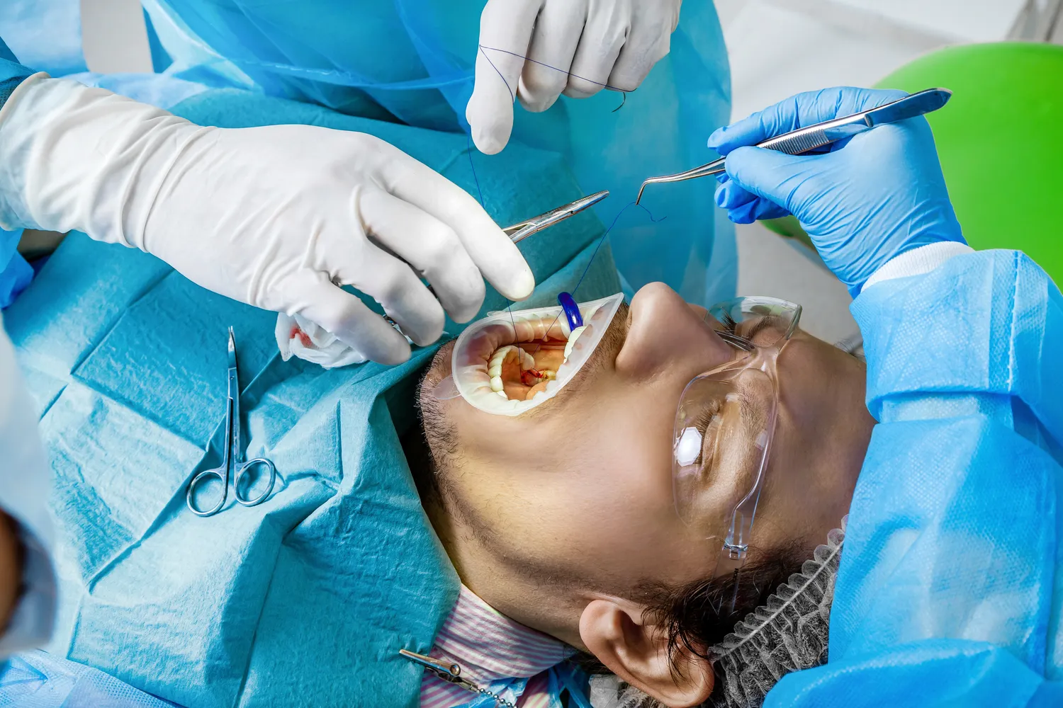 Implanty w jeden dzień Gryfice