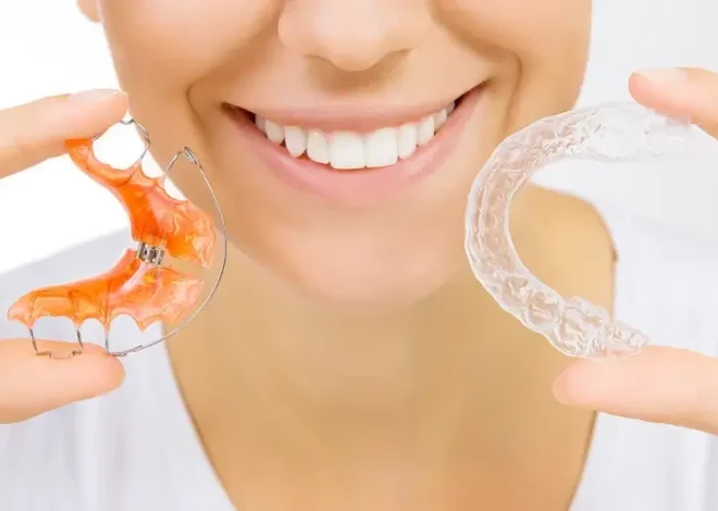 Invisalign czy zwykły aparat?