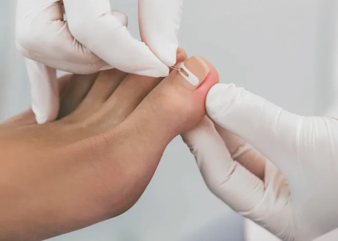 Czym zajmuje się podologia?