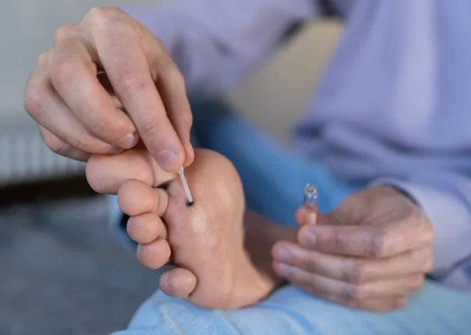 Dlaczego wychodzą kurzajki?