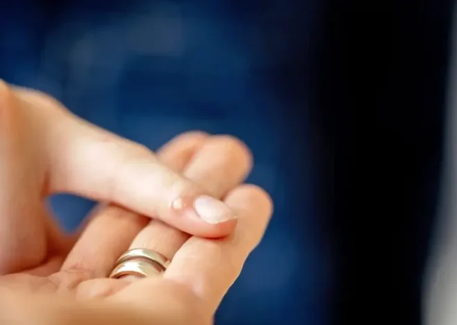 Ile leczy się kurzajki?