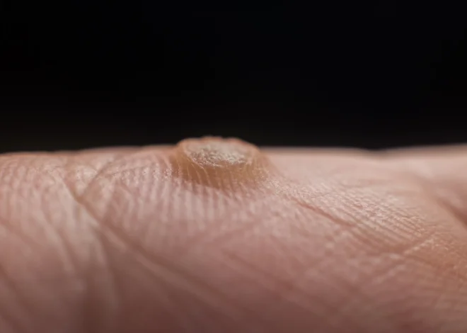 Podolog – gdy Twoje stopy wołają o pomoc