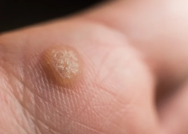 Podologia – co oznacza ten termin?