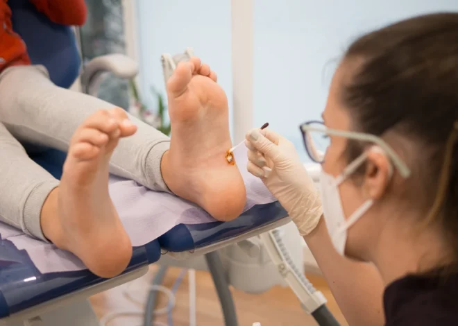 Skąd biorą się kurzajki?